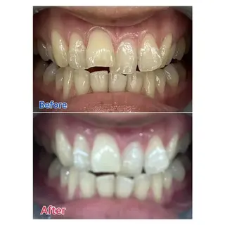 M渋谷店所属・M渋谷 ホワイトニングのエステ・リラクイメージ