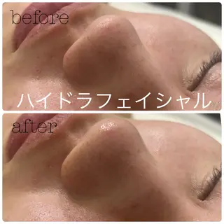 メンズ フェイシャルサロン CHIARA 荒田のエステ・リラクイメージ