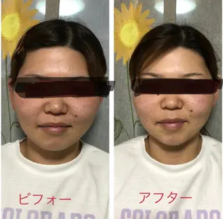 超悶絶サロンひまわり所属・村岸 恵美のエステ・リラクイメージ