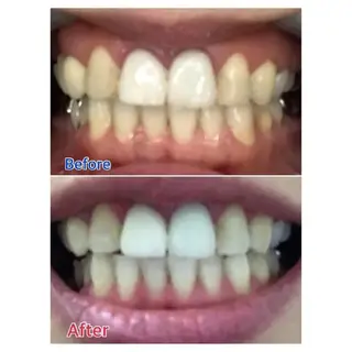 M渋谷店所属・M渋谷 ホワイトニングのエステ・リラクイメージ