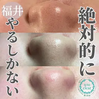 毛穴肌質ケアサロン Yourmeユアミーのエステ・リラクイメージ