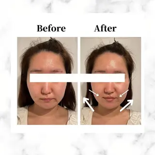 12Dハイフ💗 最強小顔のエステ・リラクイメージ