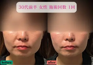 美容とカラダの鍼灸 サロン やなけんのエステ・リラクイメージ