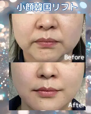 マツエク・マツパ 愛維美水光美肌専門店所属・愛維美水光美肌専門店 メンズレディースokのエステ・リラクイメージ