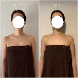 ドライヘッドスパ TOTONOESTのエステ・リラクイメージ