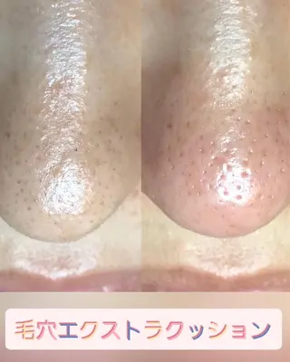 【リベルハーブピーリング認定店】敏感肌・美白脱毛専門店Dione立川店所属・Dione 立川店のエステ・リラクイメージ