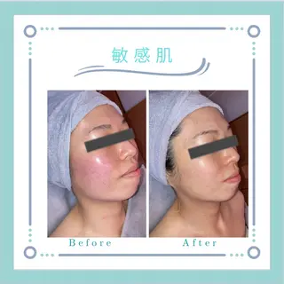 フェイシャルエステLe・Ciel所属・Le・Ciel フェイシャル&ボディのエステ・リラクイメージ