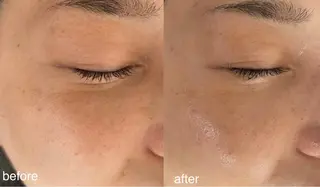 Lavi&所属・肌質改善サロン Lavi&のその他イメージ