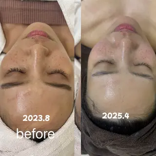 L ea Lea所属・平野 礼香のエステ・リラクイメージ