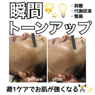 stella所属・stella都度払い 痩身小顔まつげパーマのマツエク・マツパデザイン