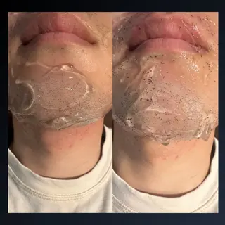 メンズ Grast所属・脱毛＆眉毛サロン メンズ専用Grastのエステ・リラクイメージ