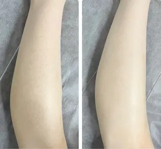 espoir所属・espoir🌿 FHR脱毛・ﾏﾂﾊﾟのエステ・リラクイメージ