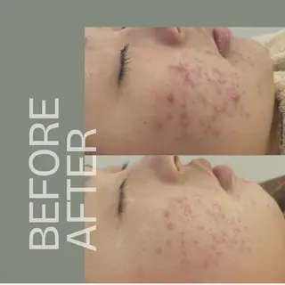 ホワイトニングショッ 吉祥寺2号店のその他イメージ