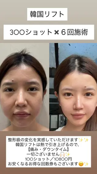 マツエク・マツパ 愛維美水光美肌専門店所属・愛維美水光美肌専門店 メンズレディースokのエステ・リラクイメージ