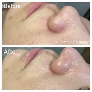 深い肌悩み専門 フェイシャルサロンのエステ・リラクイメージ