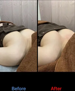 毛穴改善/脱毛 ネイル　川上久仁子のエステ・リラクイメージ