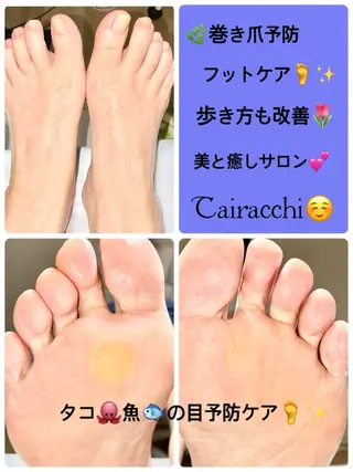 ネイル Tairacchi ﾀｲﾗｯﾁのエステ・リラクイメージ