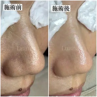 マツヤニWax専門/ 岸和田/Luanaのエステ・リラクイメージ