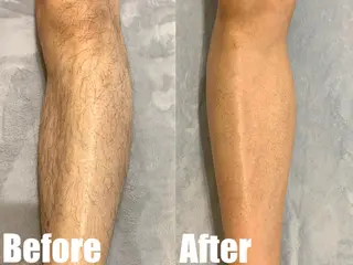 メンズ 都度払い脱毛ブレア /代々木のエステ・リラクイメージ