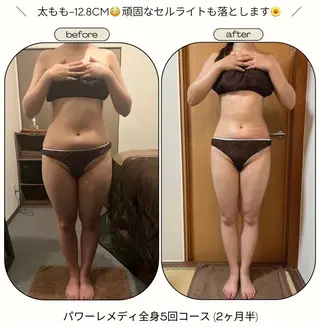 biloop所属・《本気痩せ×疲労改善 》  BILOOPのエステ・リラクイメージ