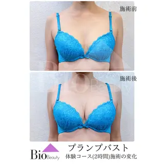 Bio Beauty 神戸本店所属・エステ豊胸マイスター 中前のエステ・リラクイメージ