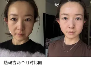 マツエク・マツパ aliaハイフ&水光ジェットサロン所属・aliaハーブ水光店 エステティシャン募集のエステ・リラクイメージ