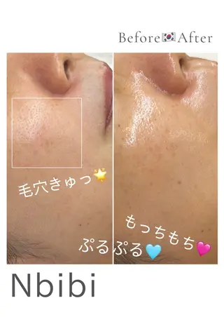 韓国🇰🇷価格 サロン_Nbibiのエステ・リラクイメージ