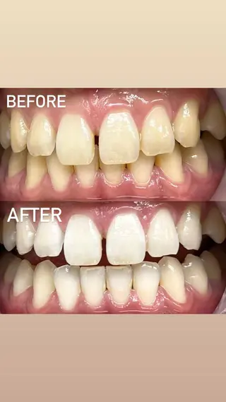 LBSホワイトニング 銀座店💎店長浦和のその他イメージ