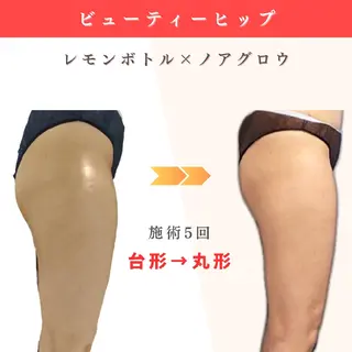 痩身小顔専門 アマテ ビューティー.Nのエステ・リラクイメージ