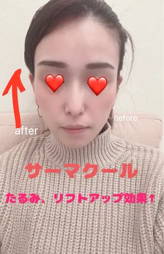 痩身Salon Charmeのエステ・リラクイメージ