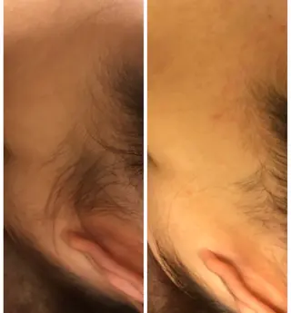 TotalSalon Briller所属・Nakashita Sayakaのエステ・リラクイメージ