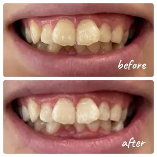 noel de mi 前川亜里沙のエステ・リラクイメージ