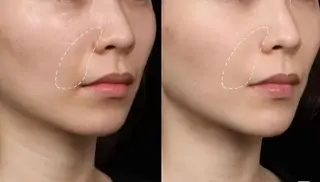 マツエク・マツパ aliaハイフ&水光ジェットサロン所属・aliaハーブ水光店 エステティシャン募集のエステ・リラクイメージ