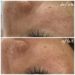 メンズ メナード岐阜市茜部 杉浦のエステ・リラクイメージ