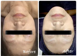 Genesis Plus大津京店のエステ・リラクイメージ