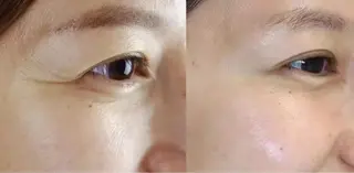 マツエク・マツパ aliaハイフ&水光ジェットサロン所属・aliaハーブ水光店 エステティシャン募集のエステ・リラクイメージ