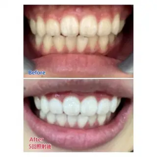 M渋谷店所属・Ｍ渋谷 ホワイトニングのエステ・リラクイメージ