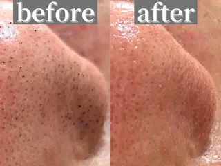 毛穴専門サロンLatiele所属・毛穴専門サロン Latieleのエステ・リラクイメージ