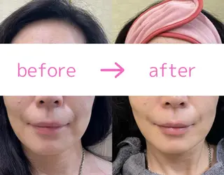 看護師が施術する 美容サロン/元治のエステ・リラクイメージ