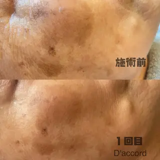 D’accord Rikoのネイルデザイン