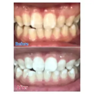 M渋谷店所属・M渋谷 ホワイトニングのエステ・リラクイメージ