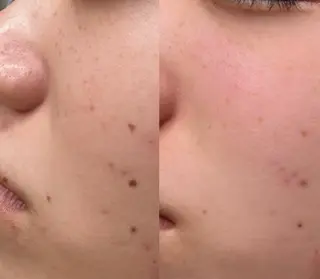 大久保 里奈のエステ・リラクイメージ