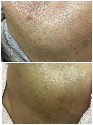 メンズ Salon Rion所属・Rion 野々村のエステ・リラクイメージ