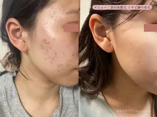 四つ星サロン🎖 腸＆ニキビケアに特化のエステ・リラクイメージ