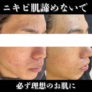 Belle beauty salon所属・Bellebeau tysalonのエステ・リラクイメージ