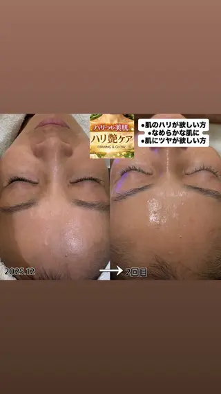 aroma  YURARI所属・韓国艶美人// 毛穴ケア🌹のエステ・リラクイメージ