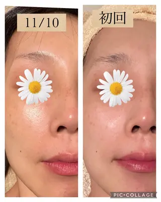 美肌専門salon クオレのエステ・リラクイメージ