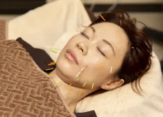 Acupuncture  salon LINOA リノア鍼灸院所属・ヘッドスパ鍼/小顔鍼 EMS LINOAのエステ・リラクイメージ