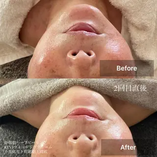 メンズ キッズ 美肌・リラクゼーションサロンLu,Mie所属・美肌と癒しのサロン Lu,Mieのエステ・リラクイメージ