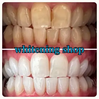 ホワイトニング ショップ吉祥寺2号店のその他イメージ